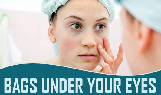 Bags Under Your Eyes