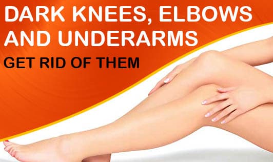 Dark Knees, Elbows and Underarms- Get Rid of Them