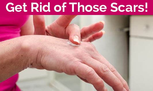 Essential Steps For Proper Wound Care