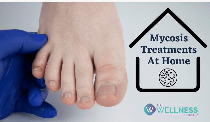 Natural Treatments for Fungal Infections (Mycosis) at Home