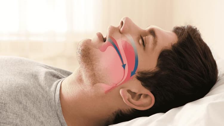 Death From A Sleeping Disorder! Hazards Of Sleep Apnea If Untreated
